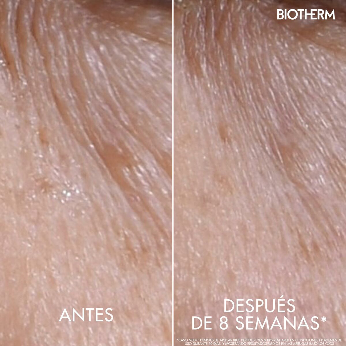 Eye Contour Biotherm BLUE PEPTIDES 15 ml